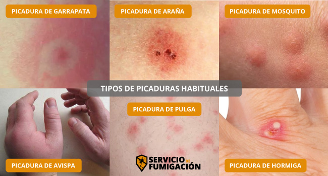 Tipos de Picaduras de Garrapatas e Insectos Habituales en serviciodefumigacion.com.mx